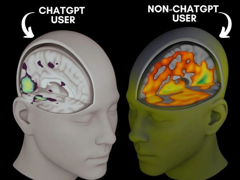 MIT quét não người dùng ChatGPT, phát hiện suy giảm hoạt động nhận thức